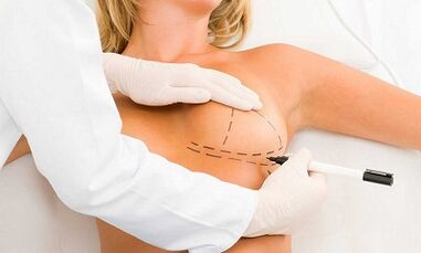 Hogyan lehetne növelni az implantátumok agyát