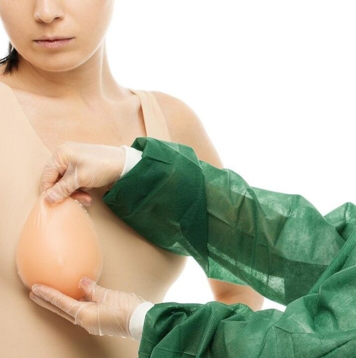mellnagyobbító implantátumok